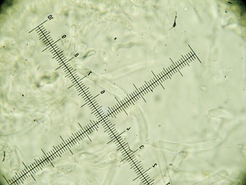 Crosta giallina da determinare (Hyphoderma radula)